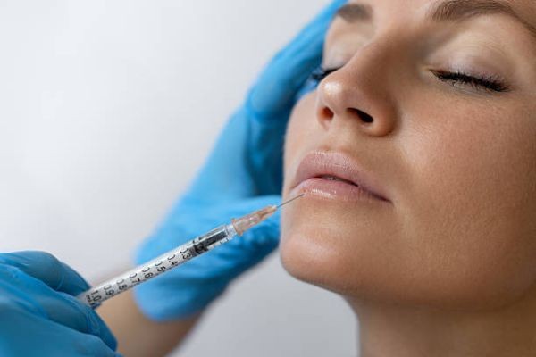 Volite Fillings in Dubai for Premium Skin Quality Treatment