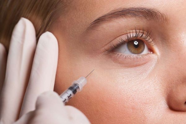 Melasma Treatment: Restore Your Skin’s Natural Glow with Advanced Solutions