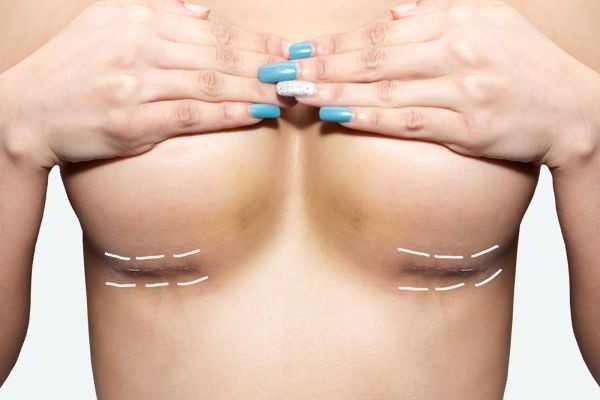 What to Know Before Choosing Breast Augmentation in Islamabad