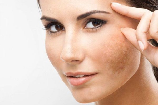 How Age-Related Pigmentation Develops and How to Manage It
