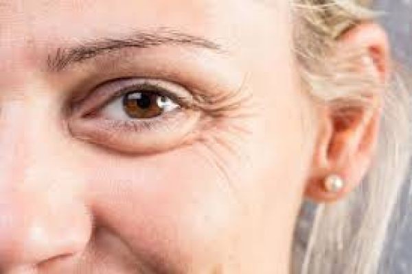 Youthful Skin Goals: Addressing Fine Lines and Wrinkles in Dubai