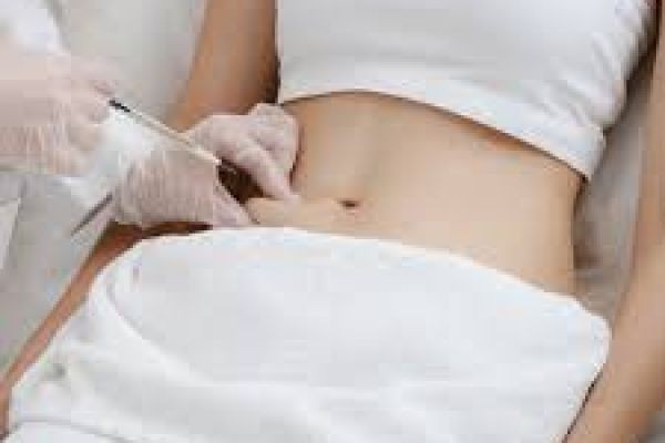 Common Treatment Areas for Fat Melting Injection in Dubai: A Complete Guide to Targeting Stubborn Fat