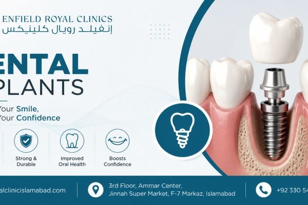 The Gold Standard for Replacing Missing Teeth Dental Implants: