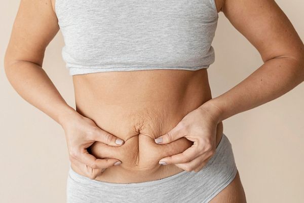 Tummy Tuck in Islamabad: Your Guide to Safe and Natural-Looking Results