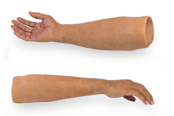 How Custom Partial Hand Prosthetics Help Restore Confidence and Everyday Living