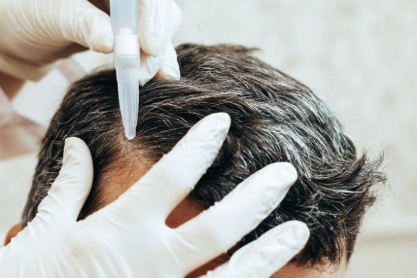 Top Things to Know About Exosome Hair in Dubai Today