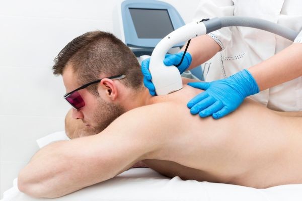 Permanent Hair Removal Laser Price in Pakistan for Men and Women Explained