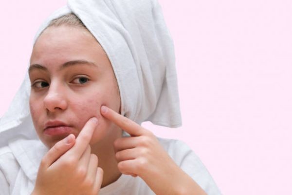 Acne Treatment and Facial Cleansing: Best Practices Explained