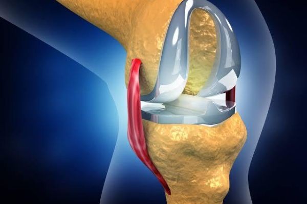 Knee Replacement Surgery Pain Relief