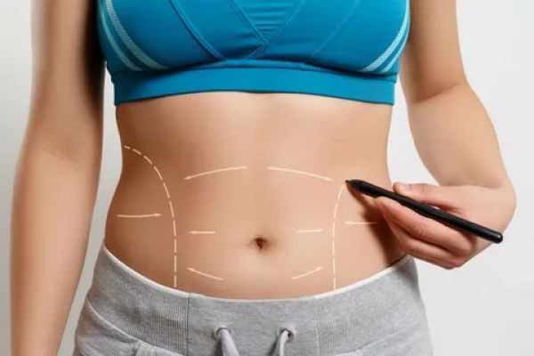 Tummy Tuck in Dubai: Your Roadmap to Better Posture