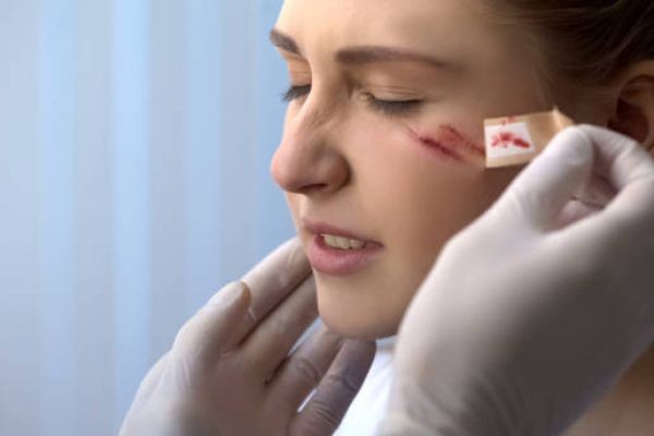 Where to Start With Facial Scar Revision in Dubai for Scars