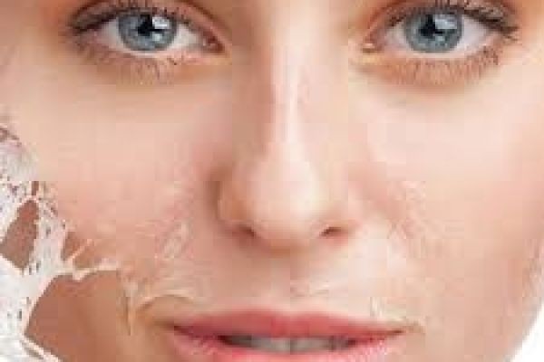 Is Chemical Peels in Dubai Right for Your Skin Type? | Complete Skin Guide