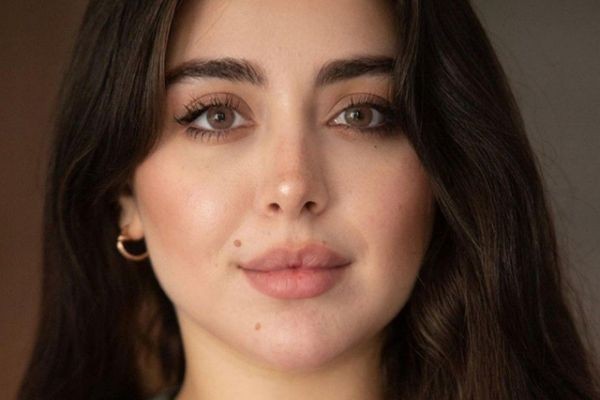 Lip Fillers: Enhance Your Natural Beauty with Fuller, Balanced Lips
