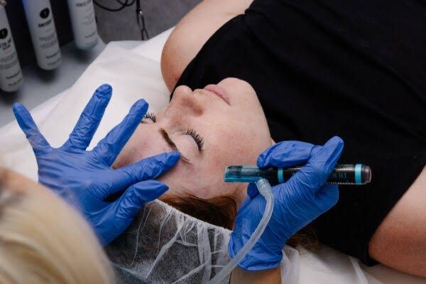 Can Hydrafacial in Pakistan Help with Acne and Oily Skin?