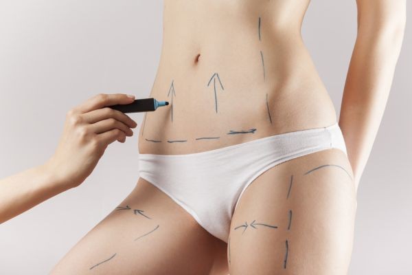 Liposuction in Islamabad: The Shape Architecture Approach to Modern Body Refinement