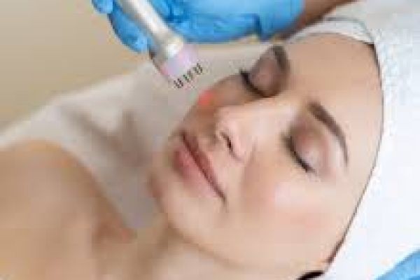 Endolift Treatment in Dubai for Facial Rejuvenation