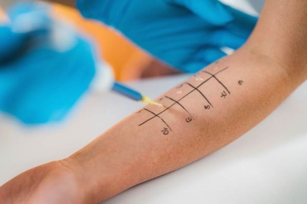 Allergy Testing: Understanding Your Triggers and Treatment Options
