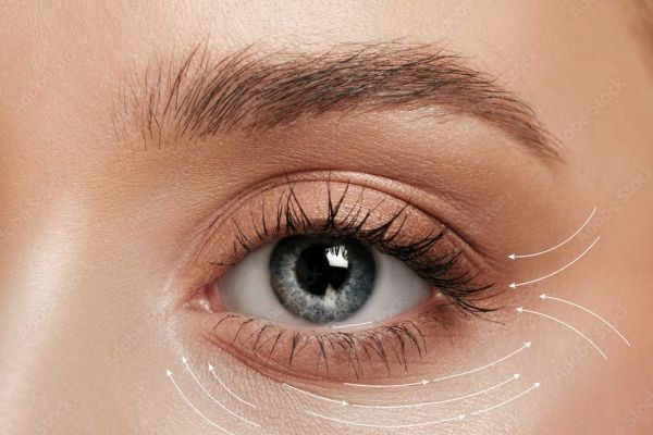 Blepharoplasty in Dubai: Refresh Your Eyes and Clear Your Vision