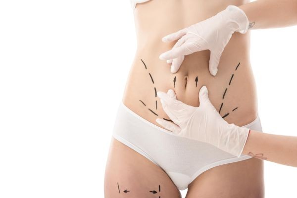 Liposuction in Islamabad: Understanding How Individual Anatomy Shapes Body Contouring Plans