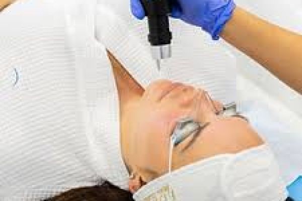 Pico Laser Treatment in Dubai for Pigmentation