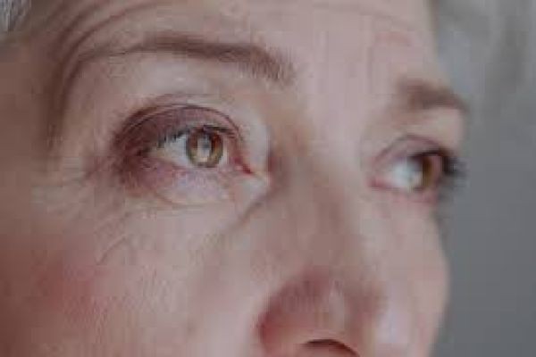 Fine Lines and Wrinkles Treatment in Dubai | Skin Rejuvenation