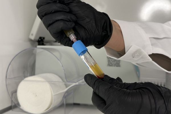 Blood Volume Analyzer Market Outlook: Growth, Innovation, Applications, and Future Opportunities