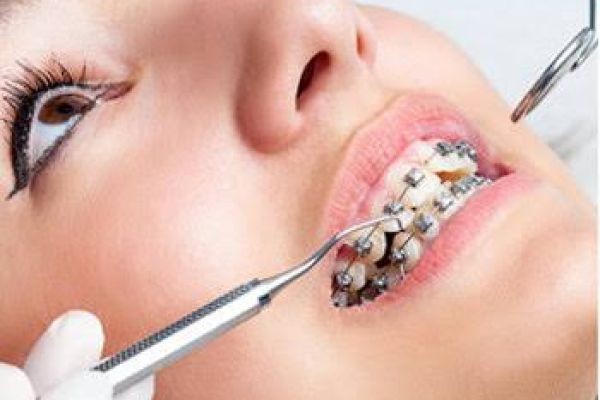 Top 10 Reasons to Choose Orthodontics Tracy for Your Family