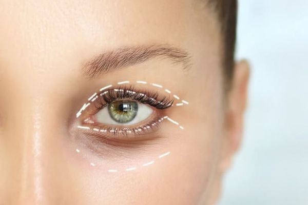 Blepharoplasty in Dubai: Upper & Lower Eyelid Solutions