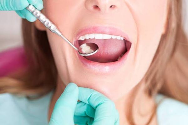 Top 10 Benefits of Visiting a Dentist Monroe Township Regularly