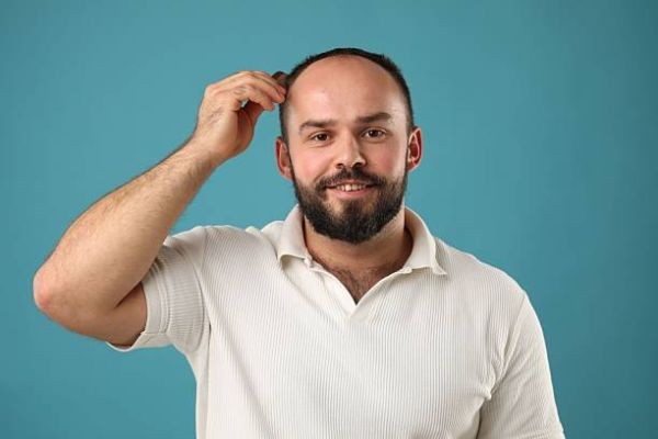 Stem Cell Hair Transplant: When It Makes More Clinical Sense