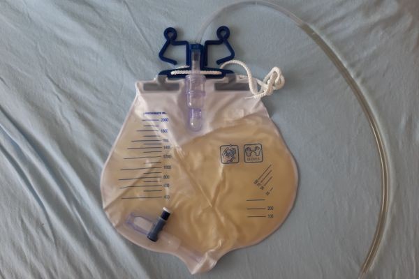 Urinary Bag Market Long-Term Outlook: Future Industry Development, Technology Adoption, and Healthcare Evolution