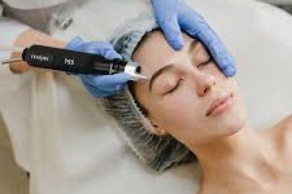 Laser Skin Resurfacing in Dubai for Fine Lines & Scars