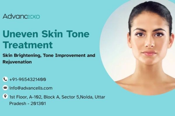 Uneven Skin Tone Treatment: Skin Brightening, Tone Improvement and Rejuvenation